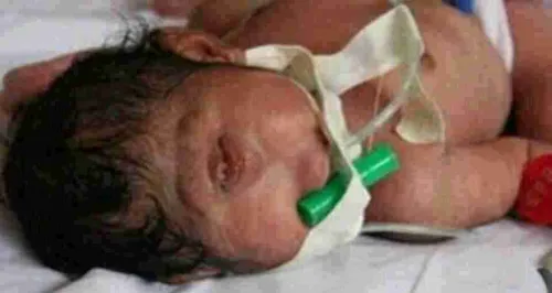 انتشار گسترده تصویر "نوزادشبیه دجال"درفضای مجازی جهان عرب