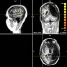 متخصصان ایتالیایی کشف کردند مغز انسان قادر است همانند یک 