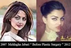 زیباترین زن ایران:مه لقا، قبل و بعد عمل زیبایی