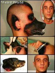 این انسان کثیف از برزیل که با پیوند پوزه سگ خودش رو شبیه 