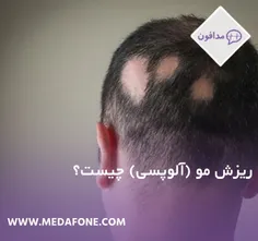 دلایل رایج ریزش مو: