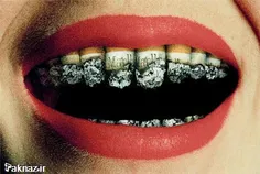 سیگار دندان ها را از بین میبرد