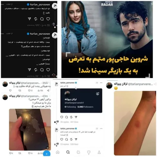 خبر تعرض شروین حاجی پور به ترلان پروانه در فضای مجازی جنج