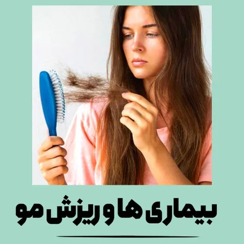 دلیل دیگه ریزش مو ممکنه کمبود ویتامین و مواد مغذی بدنت با