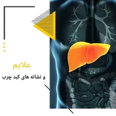 ☑️ علائمی هشدار دهنده مبتلا به «کبد چرب»