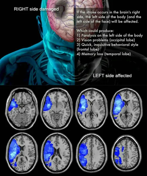 مغز انسان بسیار حساس است،قسمتی خاص در نیمکره راست مغز وجو