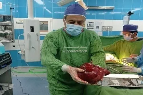 ⭕️‏جراحان و پزشکان ایرانی بازم تو یه شاهکار جدید تومور ۳.