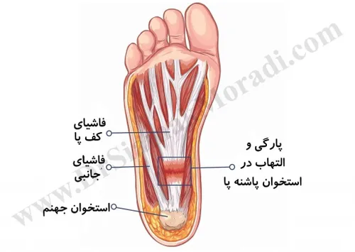 یکیومیخوام هرشب کف پامو ماساژ بده