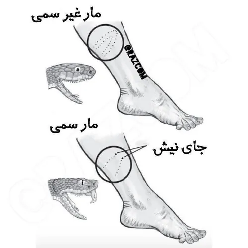 آیا میدانستید ایران پس از مکزیک رتبه دوم در مارگزیدگی در 