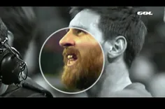 🔺  #مسی دندان خود را در الکلاسیکو از دست داد.( #تصویر )