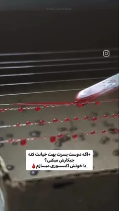 خلاصه حواستون به خودتون باشه😂👨‍🦯