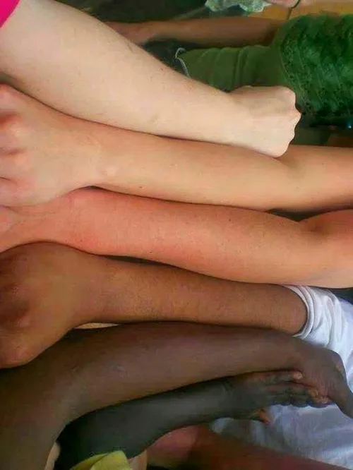شش رنگ پوست موجود در دنیا در کنار هم ...