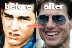 تام کروز قبل و بعد از معروف شدن
