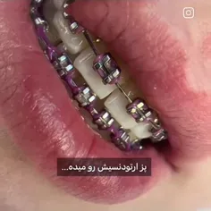 اوووووووه🤯🤯🤯