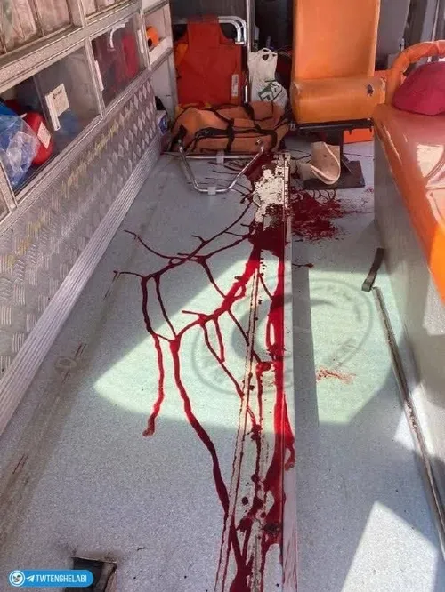 رد خون شهید عبدالرحیم فایز غنام که امروز توسط تروریستهای 