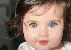 زیبا ترین جهش ژنتیکی جهان هتروکرومیا (دو رنگ بودن چشم ها)