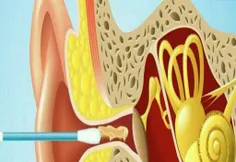 از گوش پاک کن استفاده نکنید!