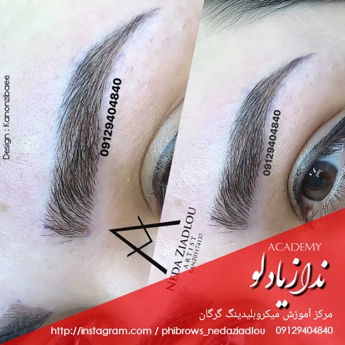 میکروبلیدینگ و میکروپیگمنتیشن گرگان ندا زیادلو 0912940484