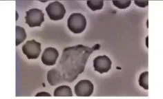 ویدئو جالبی از از گلبول سفید خون که در حال تعقیب یک باکتر