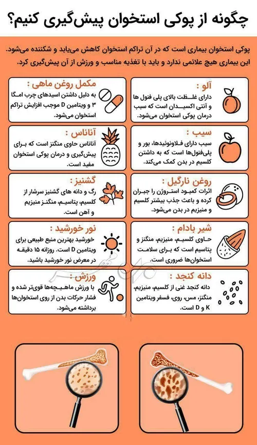 چطوری از پوکی استخوان پیش گیری کنیم؟ 🤔 پوکی استخوان پیشگی