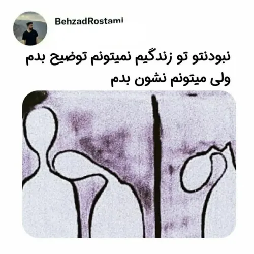 من هنوزم منتظرم برگردی🥲💔